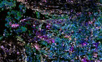 Spatialomics to detect biological signals